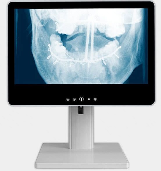 Medical panel PC 21", Intel® Core™i5, max 2.7 GHz | ACL OR-PC®LP ACL Allround Computerdienst Leipzig GmbH