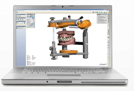 Planning software / diagnostic / simulation / medical OrthoAnalyzer™ 3shape