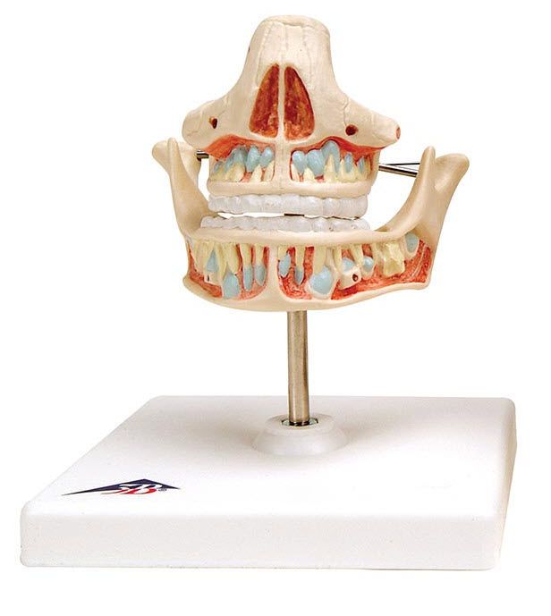 Denture anatomical model VE281 3B Scientific