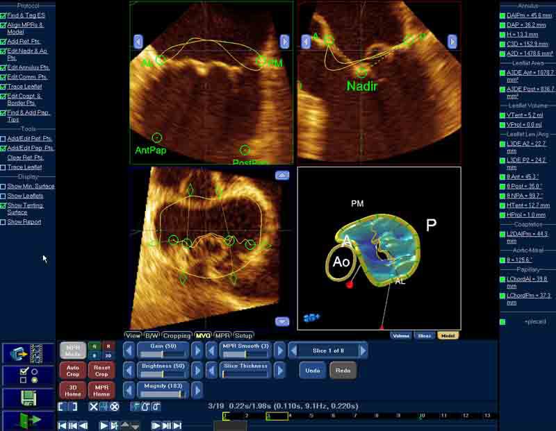 Design software / data management / analysis / reporting Q-Station Philips Healthcare