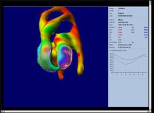 SPECT Gamma camera (tomography) / for SPECT full body / standard diameter BrightView Philips Healthcare