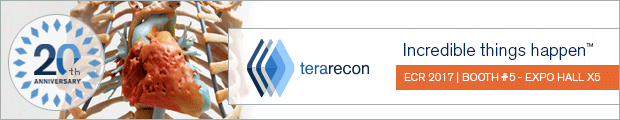 Terarecon